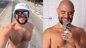 Gominho exibe corpo após perder mais de 60 kg