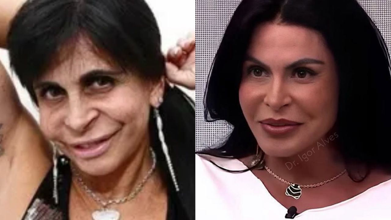Gretchen detona quem fala sobre sua aparência