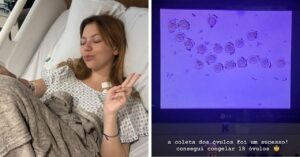 Bruna Furlan realiza congelamento de óvulos antes da quimio