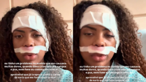Marvvila passa bem após cirurgia no ouvido e segue em recuperação com acompanhamento médico