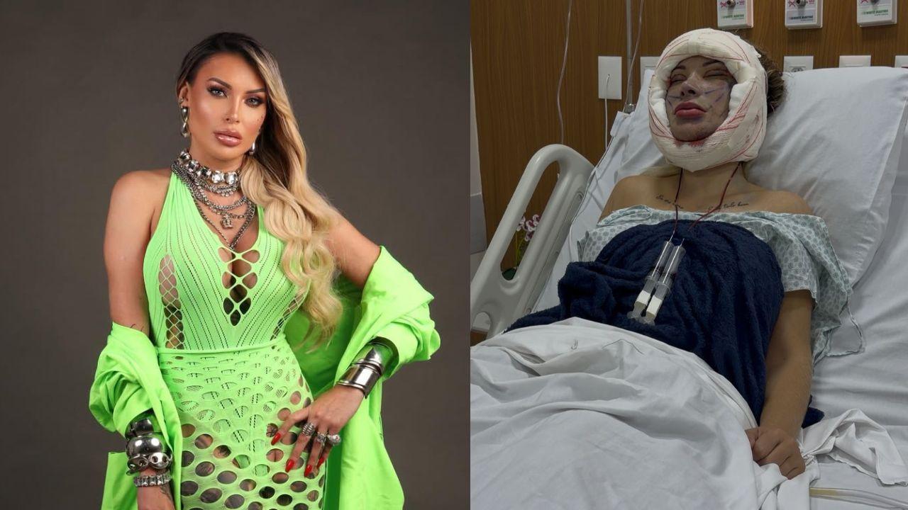 Montagem de duas fotos da Andressa Urach. Na primeira, ela está de vestido verde, em pé, maquiada. Na segunda, ela está no pós-cirúrgico, internada no hospital.